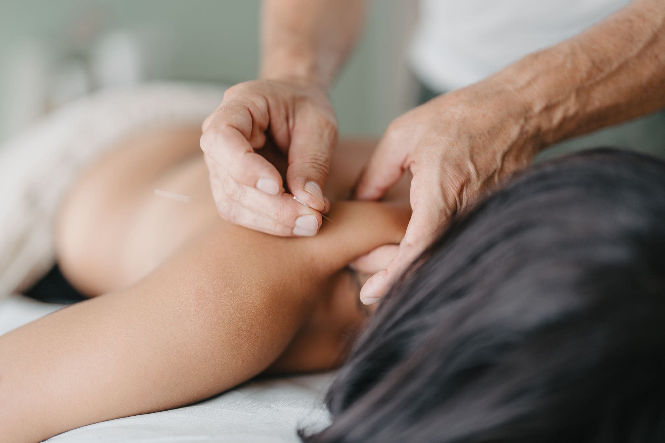 Acupuncture needle inserted into shoulder.